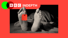 The trade in US body parts that’s completely legal – but ripe for exploitation