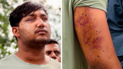 India’s ‘cockroach’ protesters have wounds consistent with pellet-gun fire, say experts